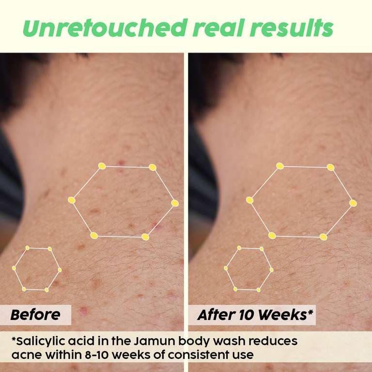 Plix Jamun 2% Salicylic Acid Body Wash For Body Acne, Bumpy Skin, 236ml | For All Skin Types